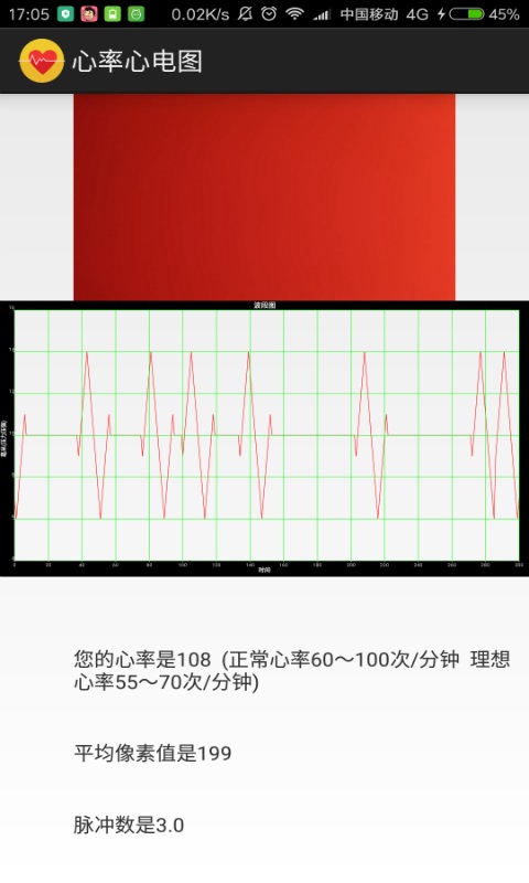 心率心电图截图