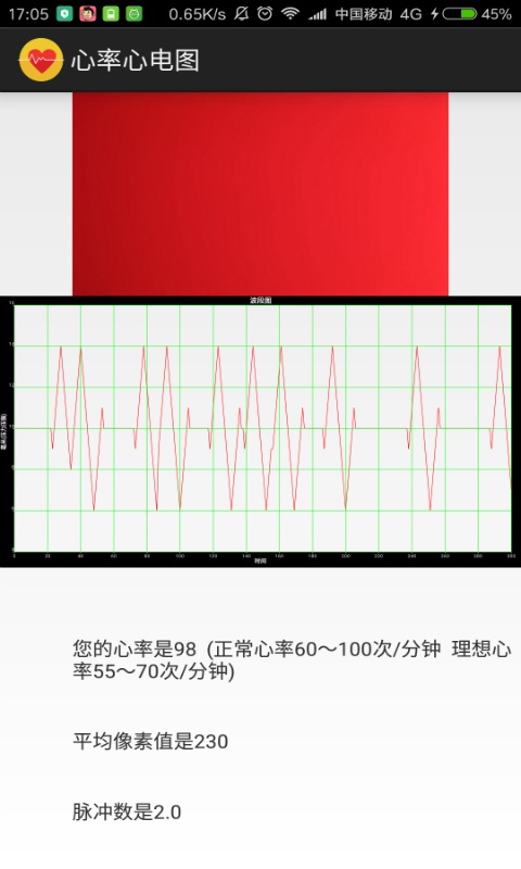 心率心电图截图