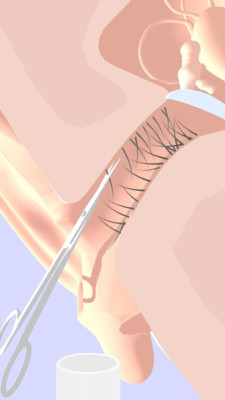 挖耳朵模擬器啊截圖