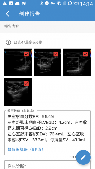 飞利浦超声报告